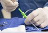 Cirurgia de varizes a laser