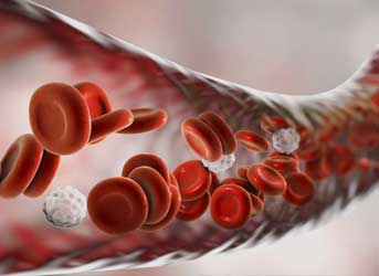 Tratamento de Lipedema em Curitiva com médico angiologista e cirurgião vascular