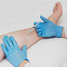 Escleroterapia, conhecida como 'aplicação de vasinhos'