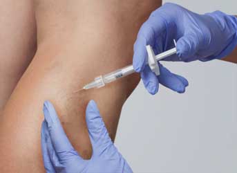 Escleroterapia em Curitiba, também conhecida como aplicação de vasinhos