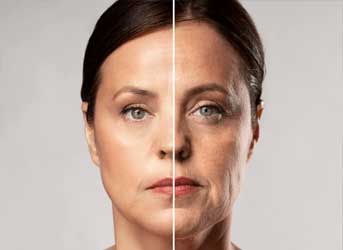 Tratamento a laser de Lifting facial sem cirurgia